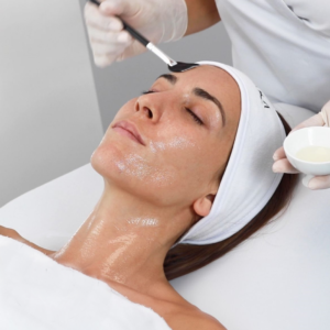 Tratamiento antimanchas.