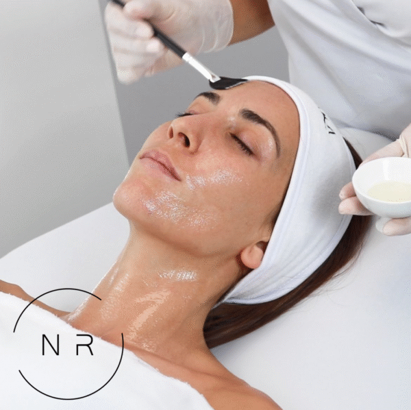 AntimanchasFacial-2025-EsteticaNoeliaRodriguez