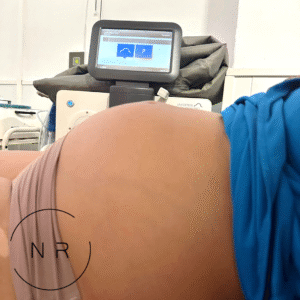 Tratamiento Corporal Postparto